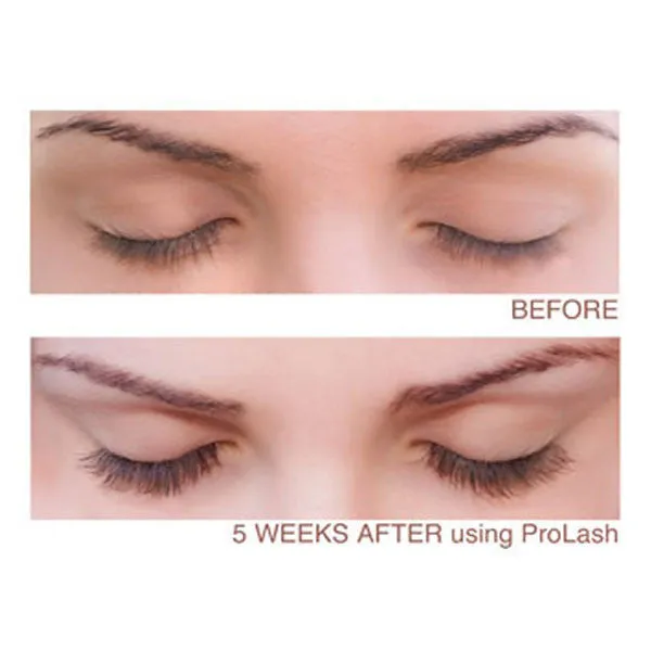 Prolash Lash Growth Enhancer